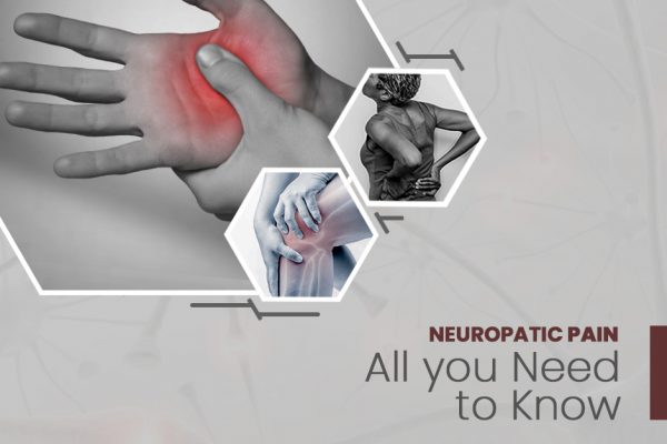 NEUROPATHIC PAIN: ALL YOU NEED TO KNOW