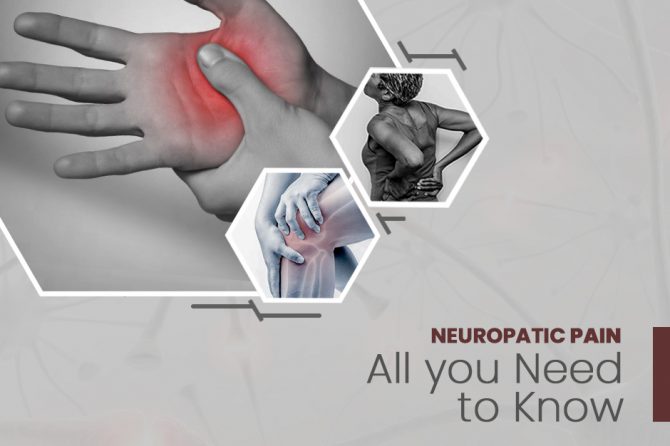 NEUROPATHIC PAIN: ALL YOU NEED TO KNOW