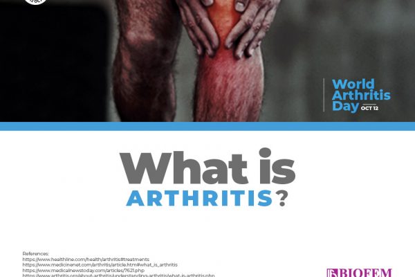 ARTHRITIS: WHAT YOU NEED TO KNOW