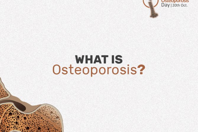 WHAT IS OSTEOPOROSIS?